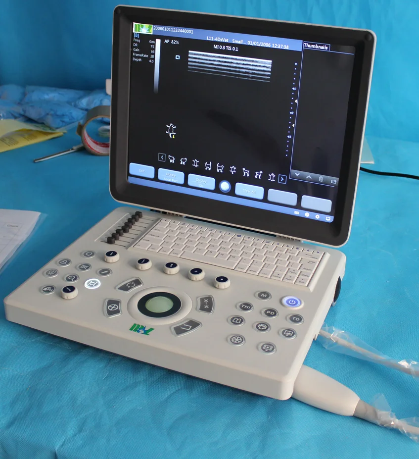 MSLPU33  portable cheap B/W ultrasound machine/ultrasound scanner for clinic