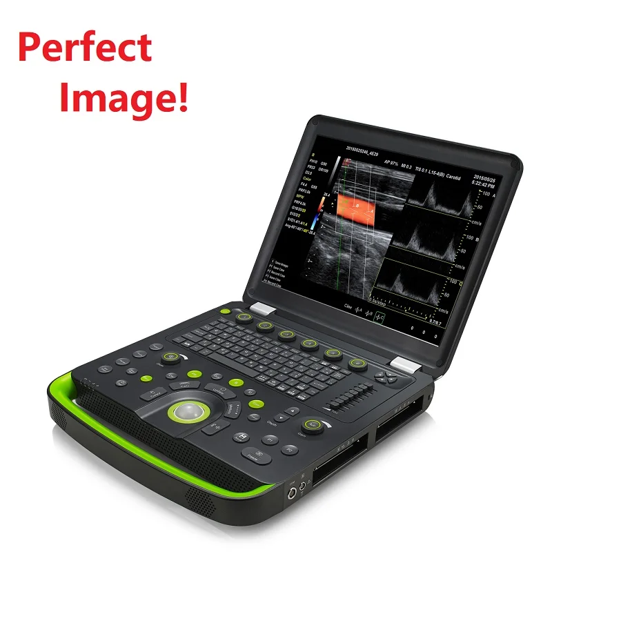 Цветной Допплер для ноутбука site-rite сосудистый ультразвуковой медицинский инструмент портативная ситеритовая Диагностическая ультразвуковая