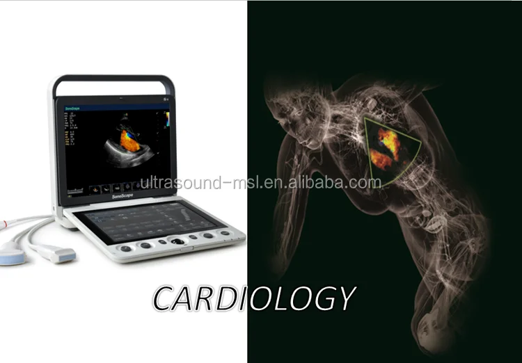 2d portable sonoscape s9 ultrasound machine price/ecografo