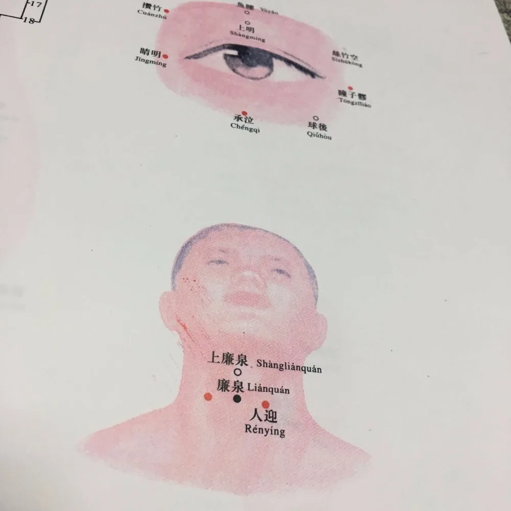 Chinese medical Acupuncture Charts points