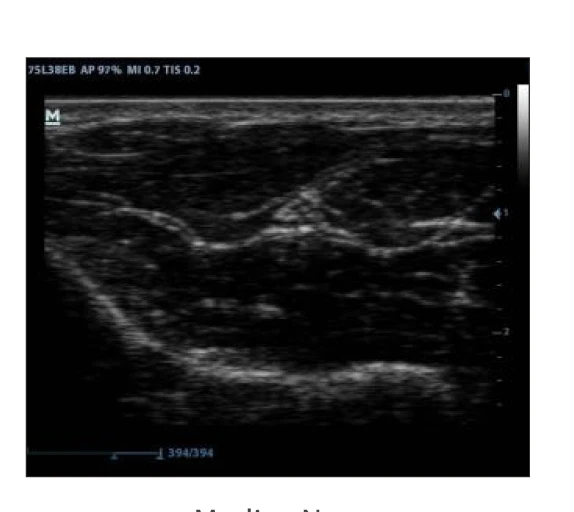 
Mindray dp 30 probe ultrasound/mindray veterinary ultrasound 