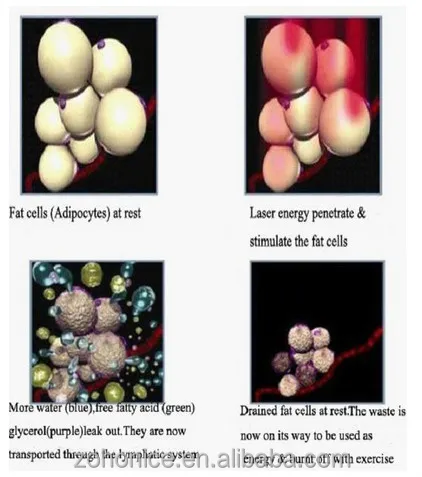 yag theropy.principle
