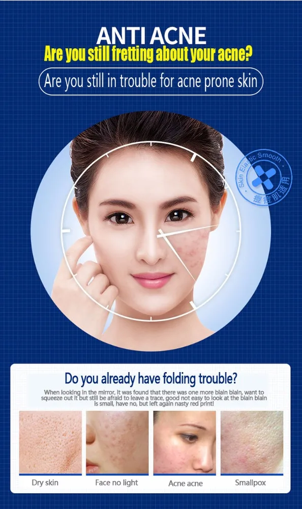 OEM IMAGES Cleaning skin Acne treatment pimple patch pimple dark spot remover face care cream facial cleanser