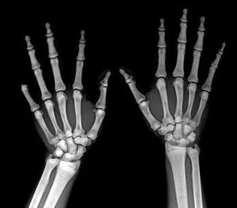 Laser X Ray Medical thermal Agfa Drystar DT1B / DT2B Film
