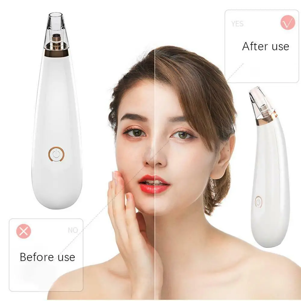 Facial Skin Care Electric Suction Remove Blackhead Pore Cleaner Vacuum Blackhead Remover Multi-function Beauty Equipment