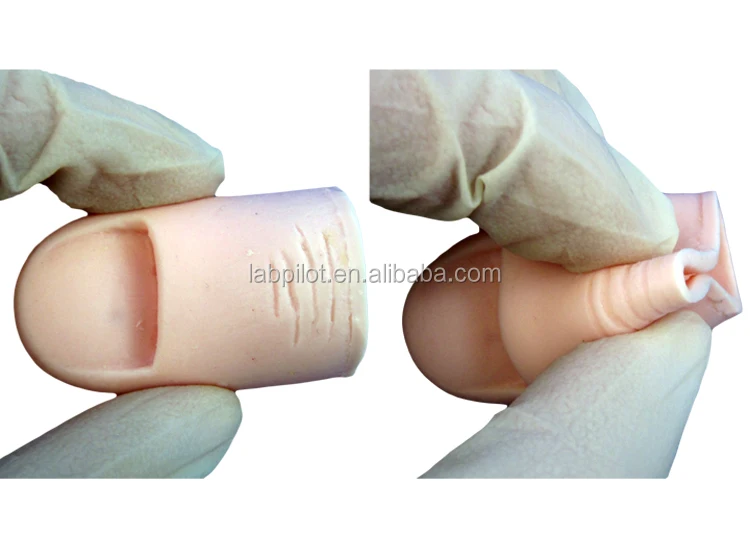 Ingrown Toenail Model,Nail Excision Training Model