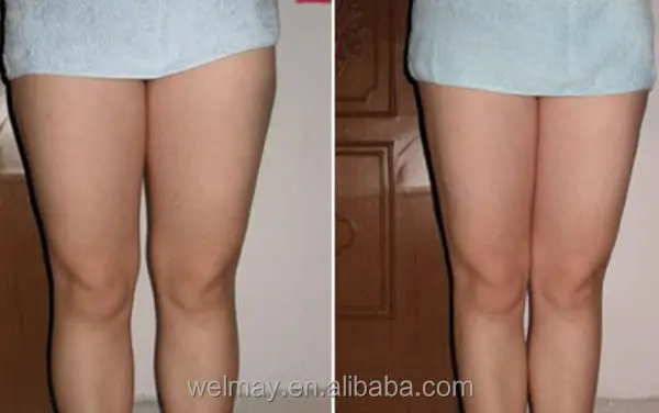 portable lymphatic drainage presoterapia air pressure pressotherapy detox slimming machine