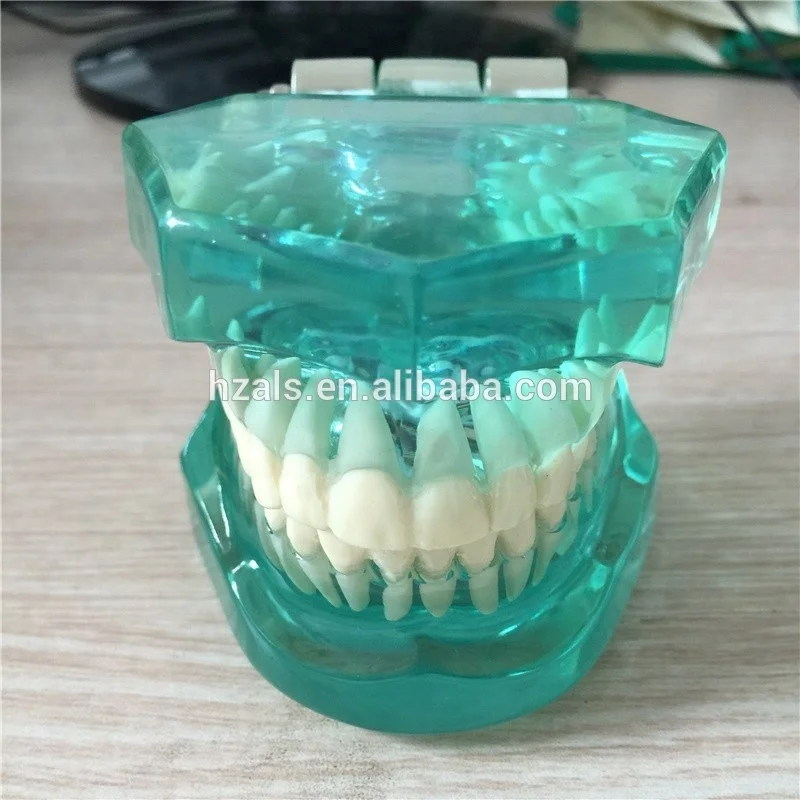 ALS Dental ceramic orthodontic Braces tooth model with Bracket