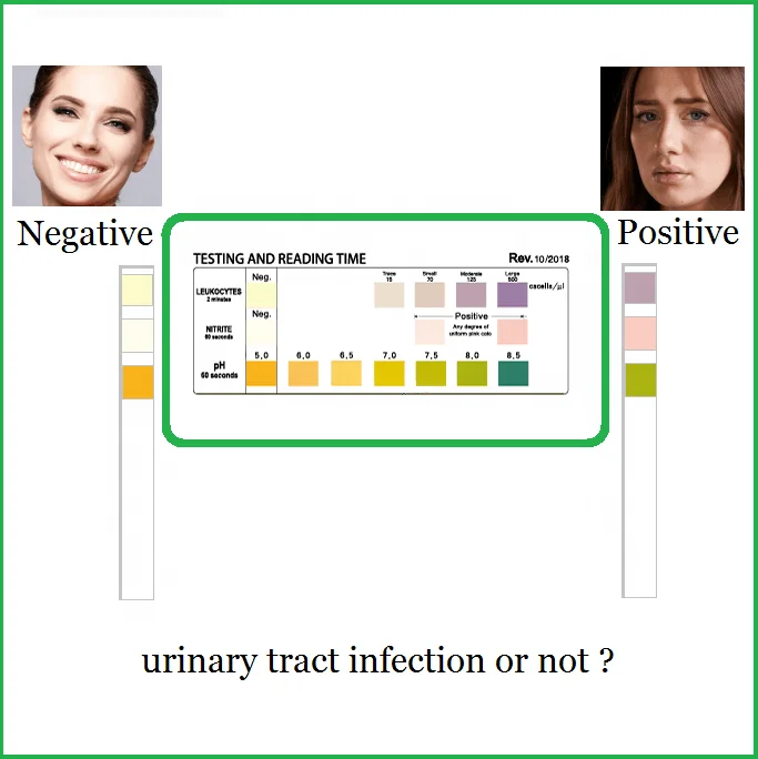 Urinalysis Test Strips 150ct  Urinary Tract Infection Strips (UTI) Urine Test Strips Test Leukocytes, Nitrite and pH
