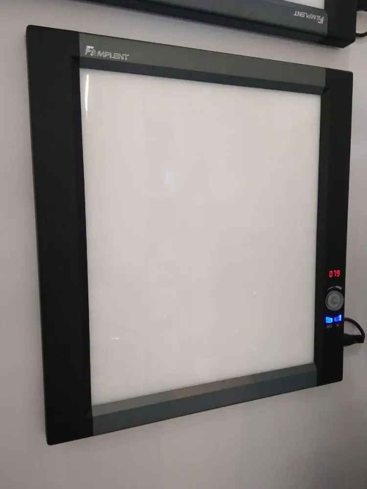Mplent ultra slim x ray film digitizer led lights radiograph viewer