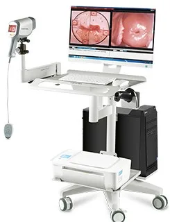 Digital HD Vagina Colposcope for Gynecology/Video Colposcope For Vagina KN-2200I