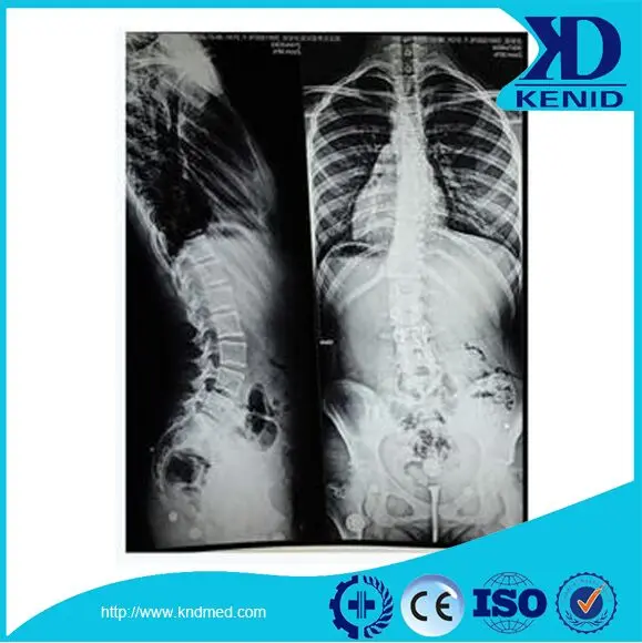 
Hot Medical Blue Film Used in Computed Tomography 