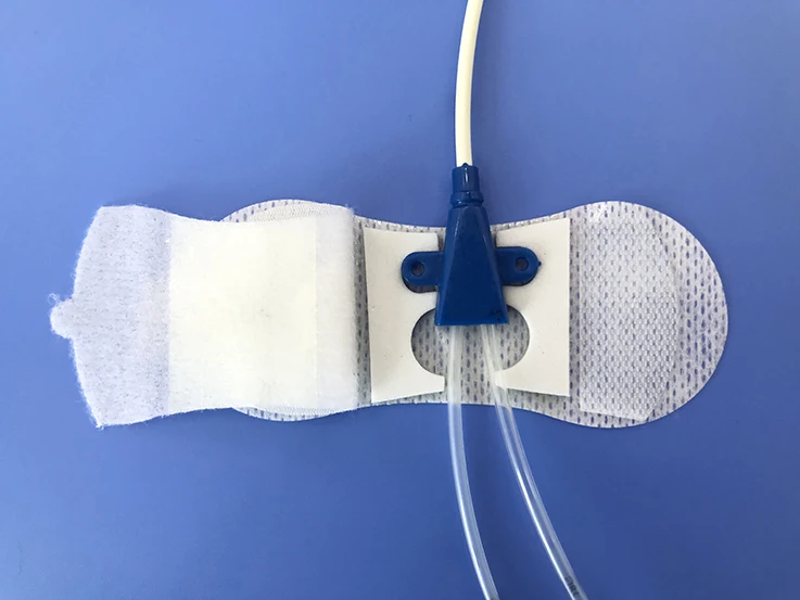 MEDICAL PRODUCT Non-woven Adhesive Catheters Fixation Tube Holder for fixing Catheter Securement