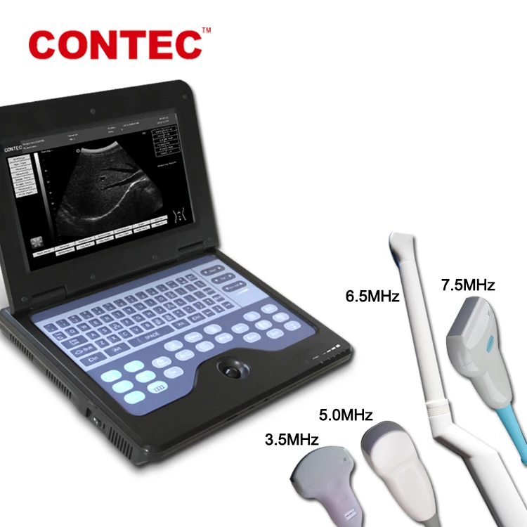 CONTEC CMS600P2 b ultrasound machine by qinhuangdao contec medical