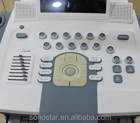 
Color Doppler System 