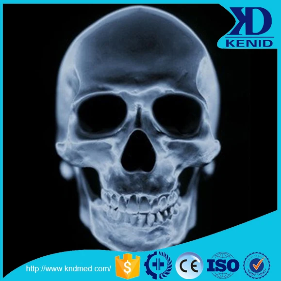 
japan brand medical brand sexy blue dry film fuji medical x-ray blue dry film 