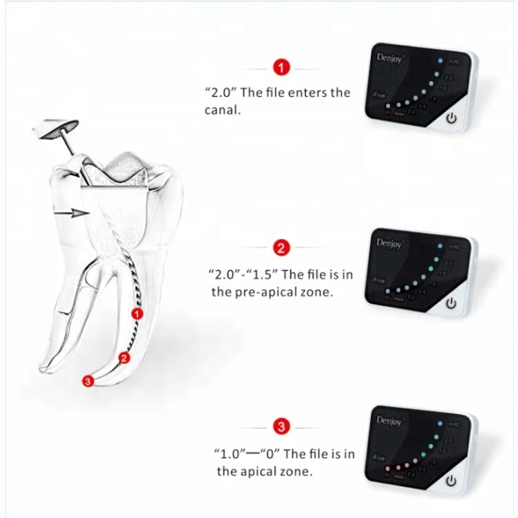 Newest Denjoy iFive Digital Dental Mini Apex Locator