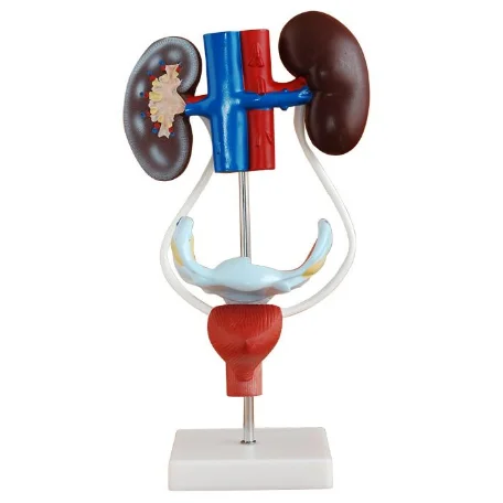 Gelsonlab HSBM-306 Advanced quality Plastic Female Urogenital System anatomical model