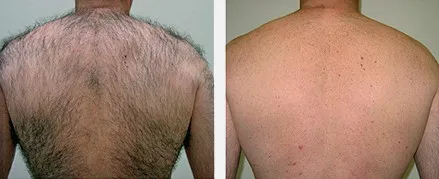 Для только что открытого косметического бизнеса, или вы планируете, 3 в 1, удаление волос, омоложение кожи и многофункциональное удаление пигментов