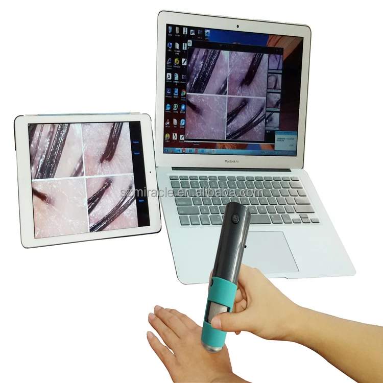 HD scalp camera wirelessly connected to mobile phones and tablets compatible with Android iOS windos system
