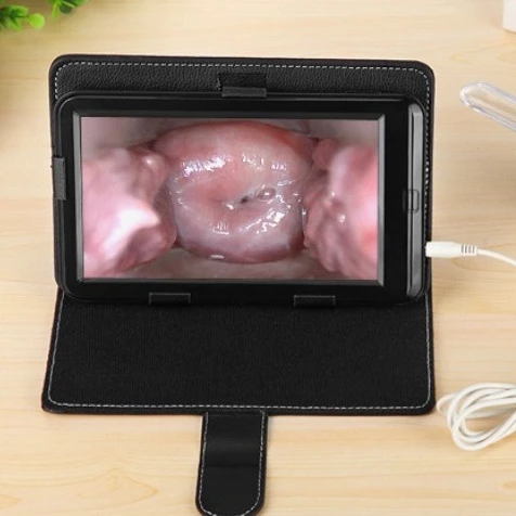 Mini Colposcope,Portable Colposcope Convenient type