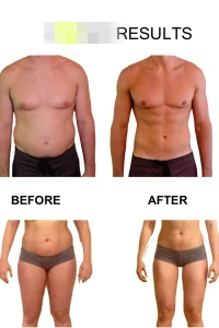 Tens ems electrotherapy electro muscle stimulation machine