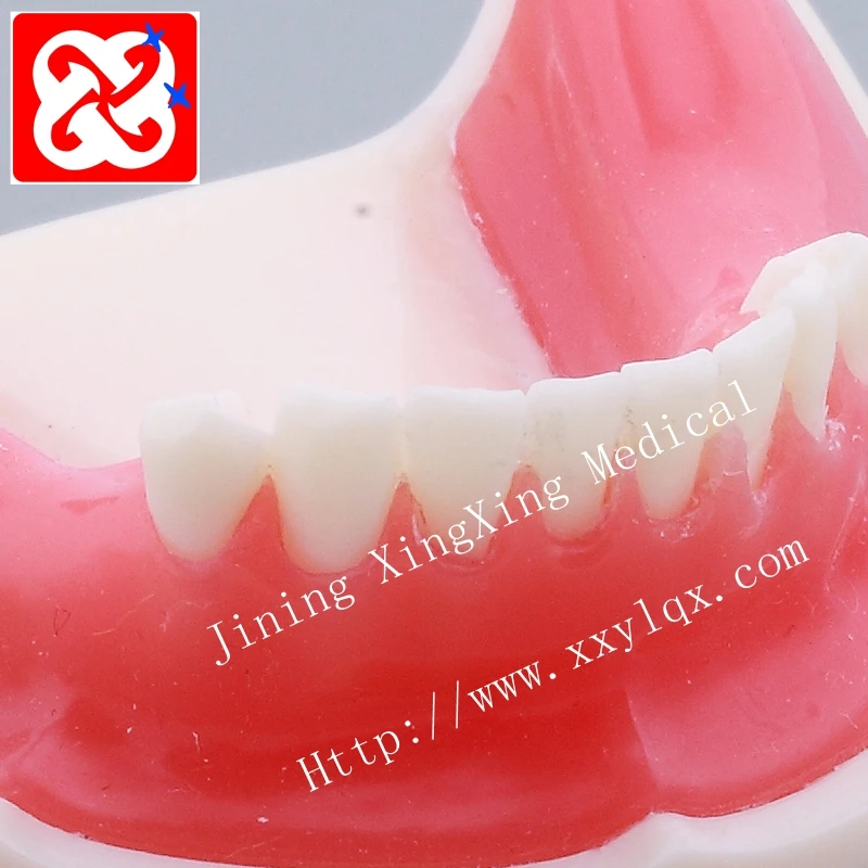 Sinus lift practice model implant model