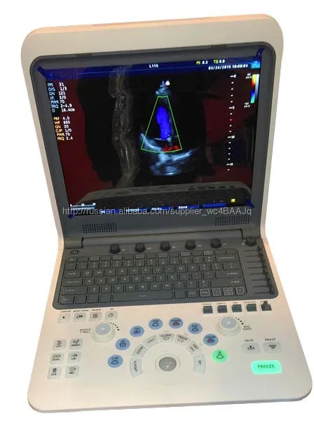 Транскраниальная доплеровский тестирование оборудования