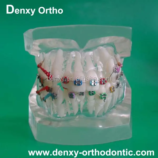 
High-quality beautiful dental supplier transparent orthodontic model 