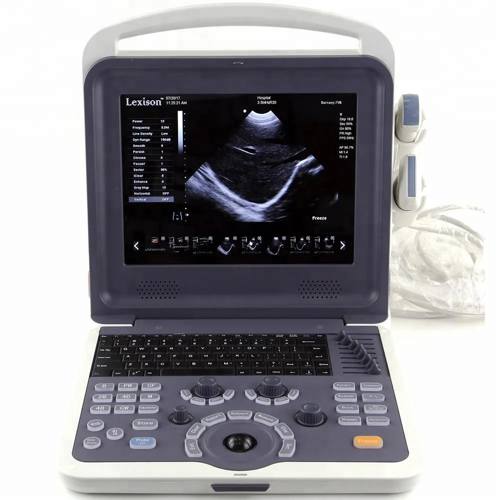 PRUS-WK60 High Quality Veterinary Color Doppler Veterinary Ultrasound Machine