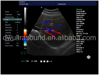 Доплеровская с жилеты зонд ultrasonido 3D DW-VET8P и цветной допплер
