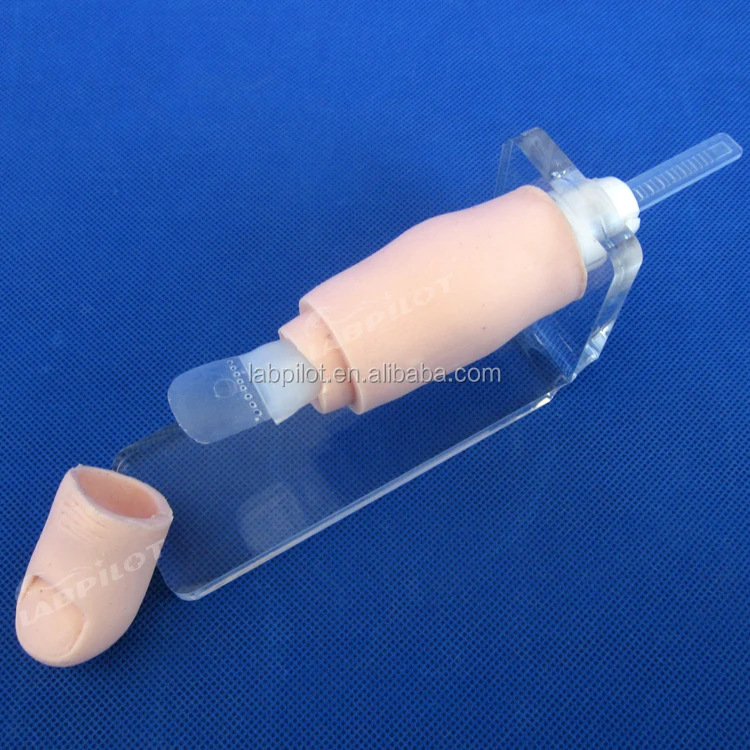 Ingrown Toenail Model,Nail Excision Training Model