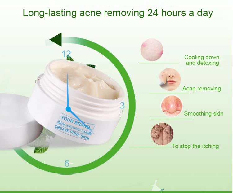 
Customizing anti acne function with your design calendula acne cream treatment 