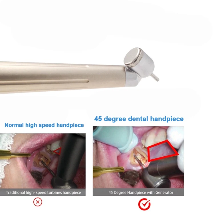 Dental 45 Degree high speed Handpiece dental air turbine handpiece with led light