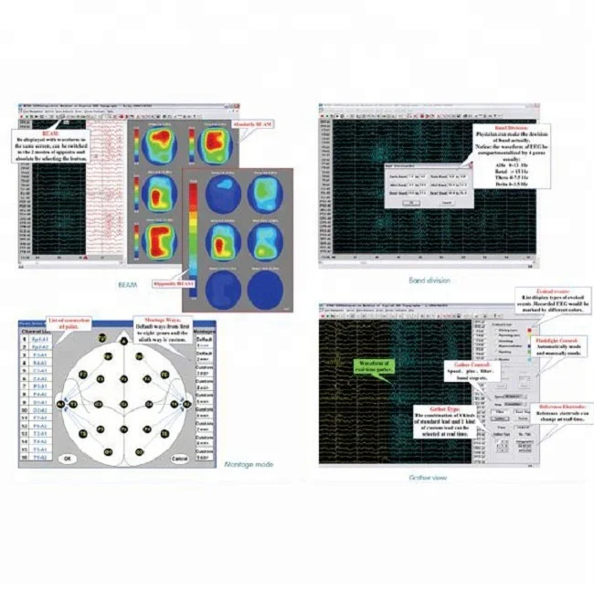 
32 Channels Digital EEG and Mapping System EEG-3200 