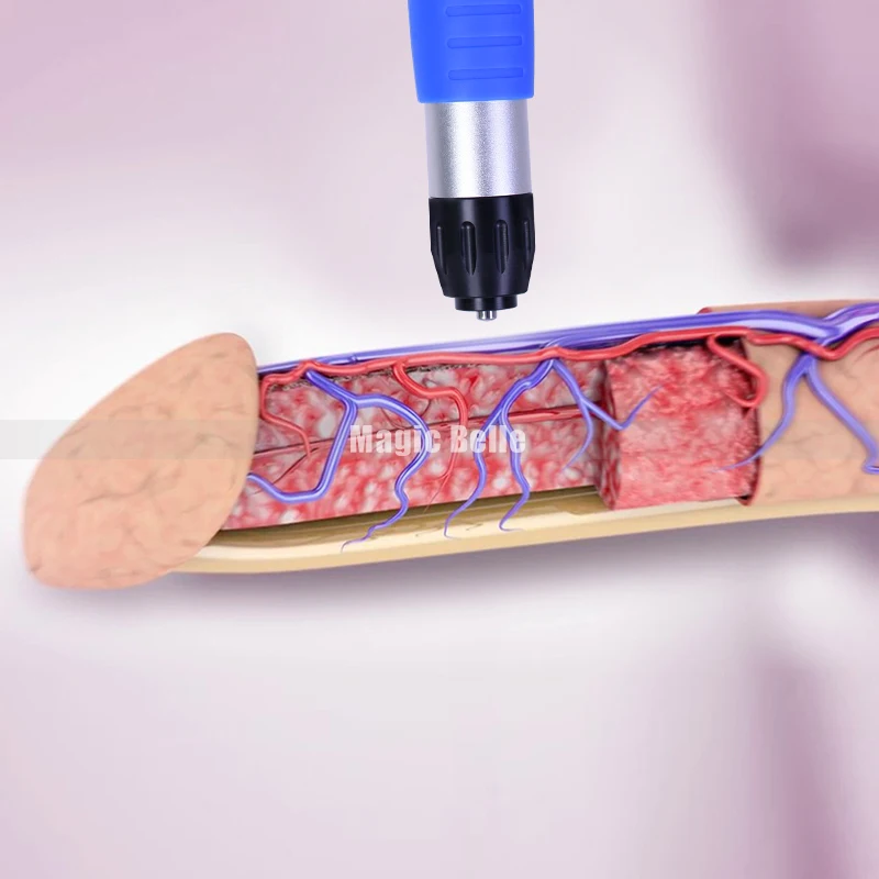 Ed 1000 ESWT Extracorporal Shock Wave Therapy Medical Equipment pain Relief Machine pain Treat Shockwave Equipment