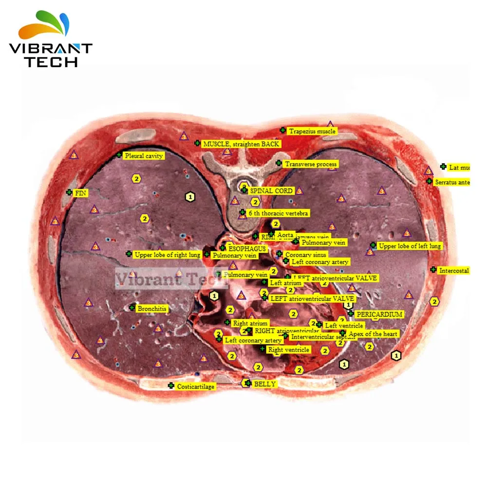 Bioplasm, нелинейная система биосенсора для сканирования здоровья тела