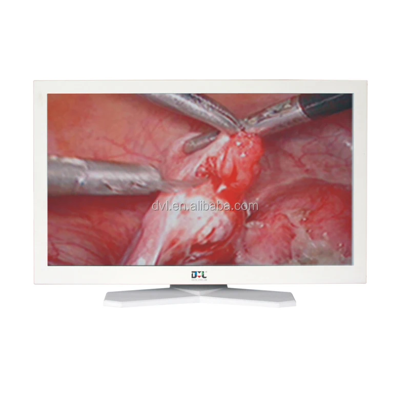 
Hot selling endoscopy system Urology tower 