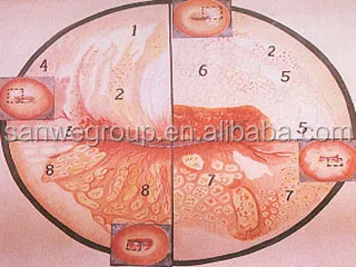 Colposcope Images