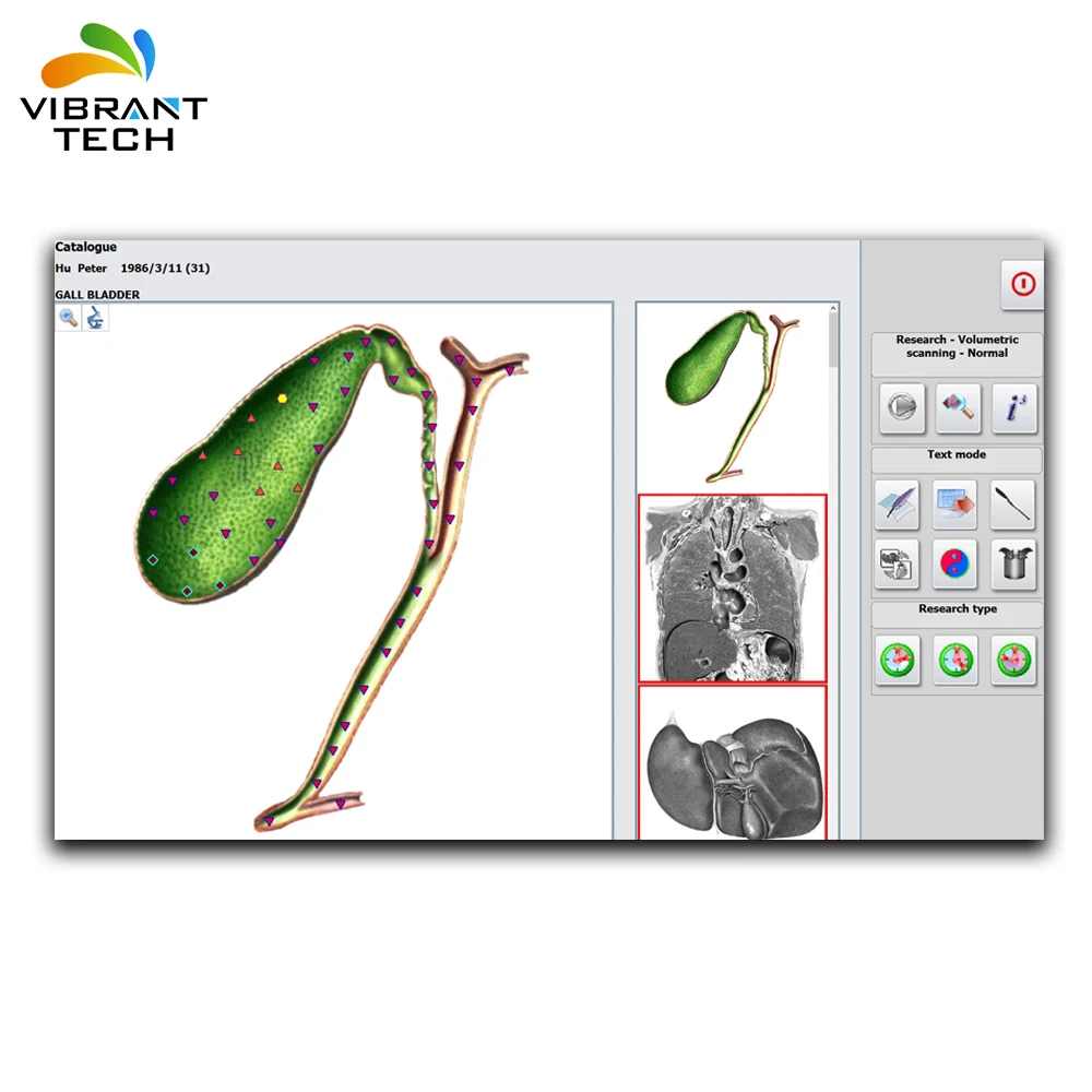 Advanced Stage Meta Hunter Body Pathological Analysis Equipment