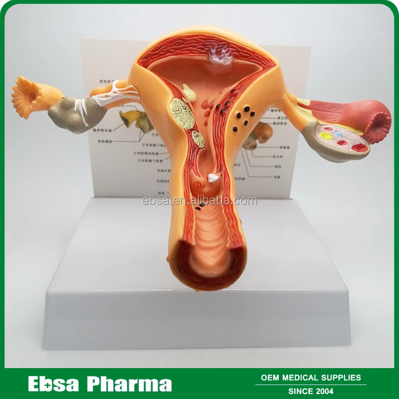 
Advanced Medical Supplies Human Teaching Anatomical Uterus Model 