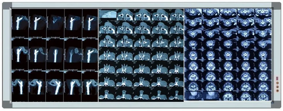 
film viewer LED light box medical agfa x ray blue film 