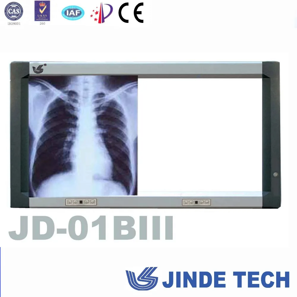 top brand JINDE medical LED film viewer, view box x-ray reader