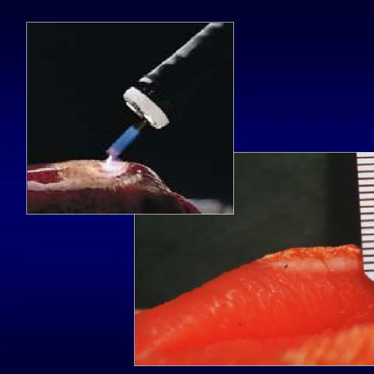 ARGON SYSTEM Electrosurgical operation theater Unit with eleven out mode surgical equipment