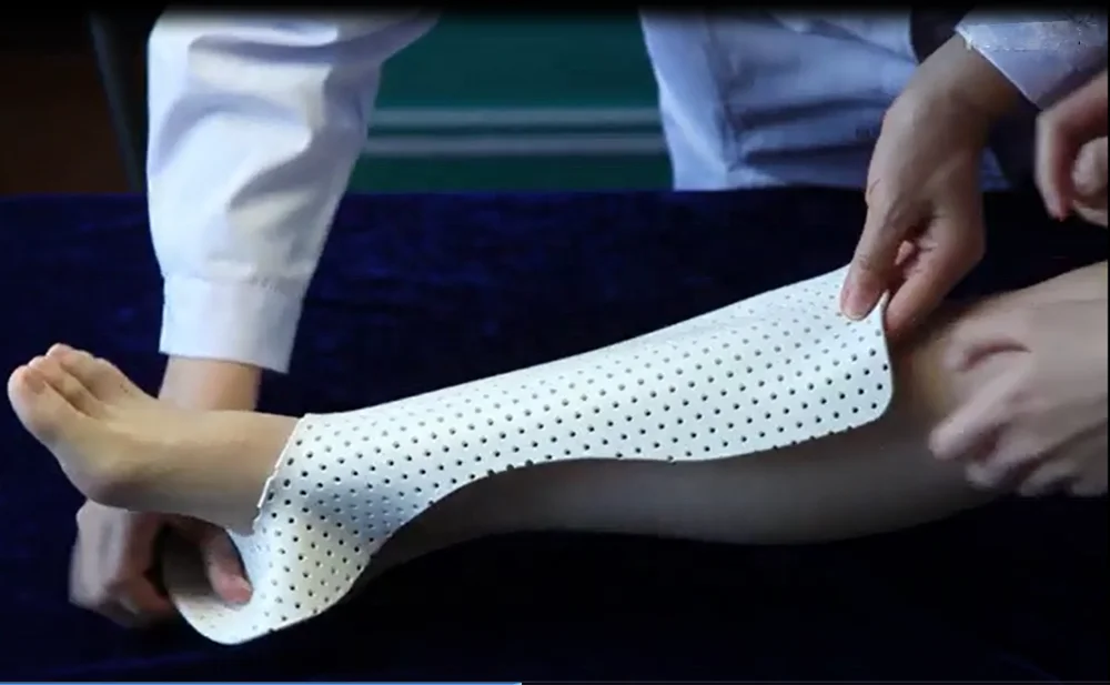 Low Temperature Thermoplastic Splint Foot Immobilization Precut Splint