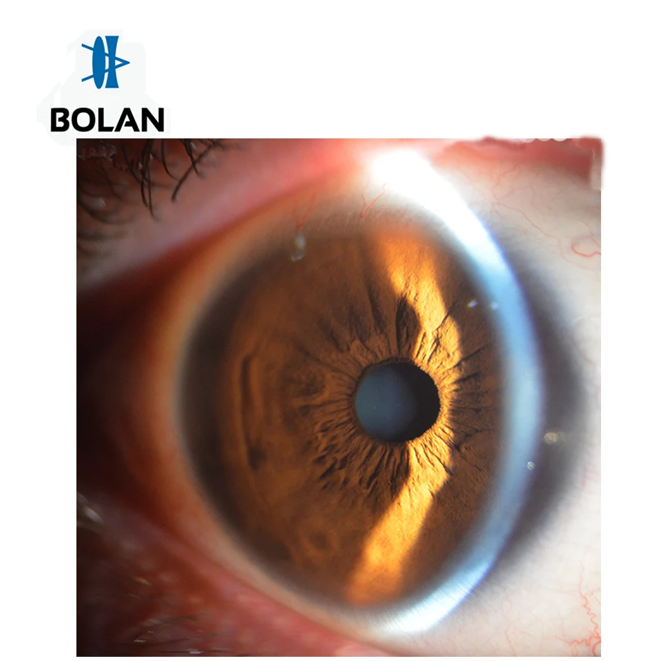 chinese BOLAN optical Slit lamp BL-IIIB with 2 maganifications Made in China