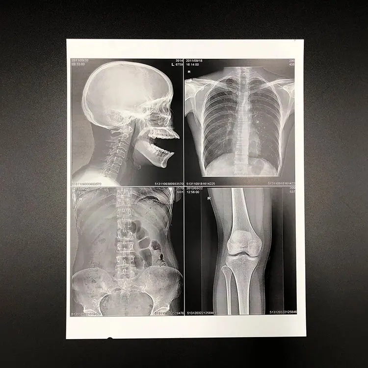 
Medical Radiation Laser Printing Film for Hospital Use 