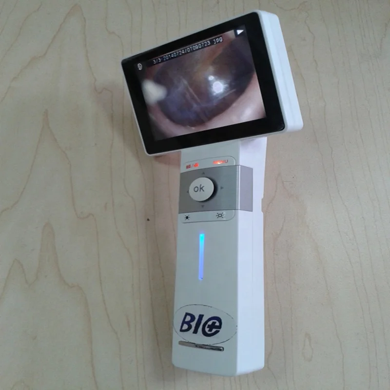 Digital ENT Otoscope Video Throat Camera Dermatoscope Endoscope With Great Price