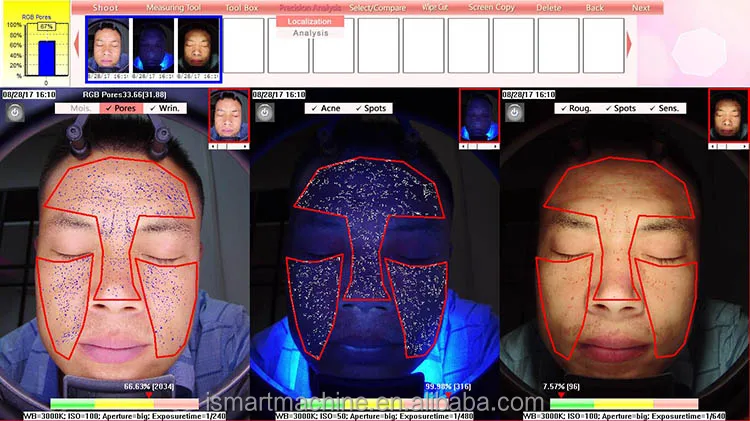 High end Facial skin analyzer portable with best price