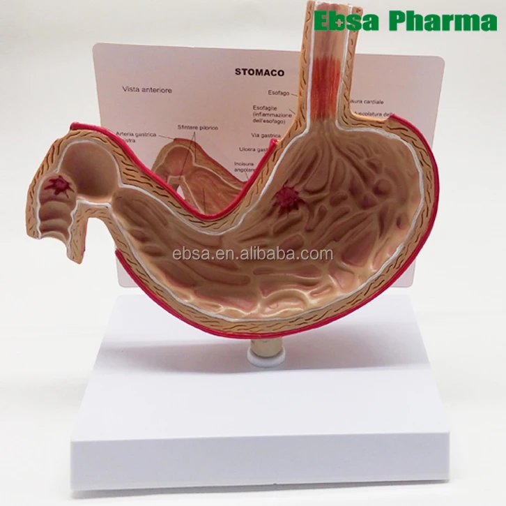 Advanced Medical Supplies Human Teaching Stomach Anatomical Model For Medical School